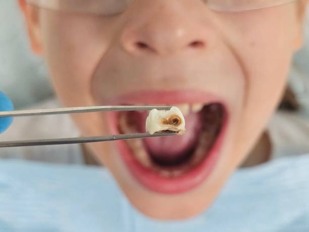 Best Orthodontic Emergency Dentist in Cedville, AR